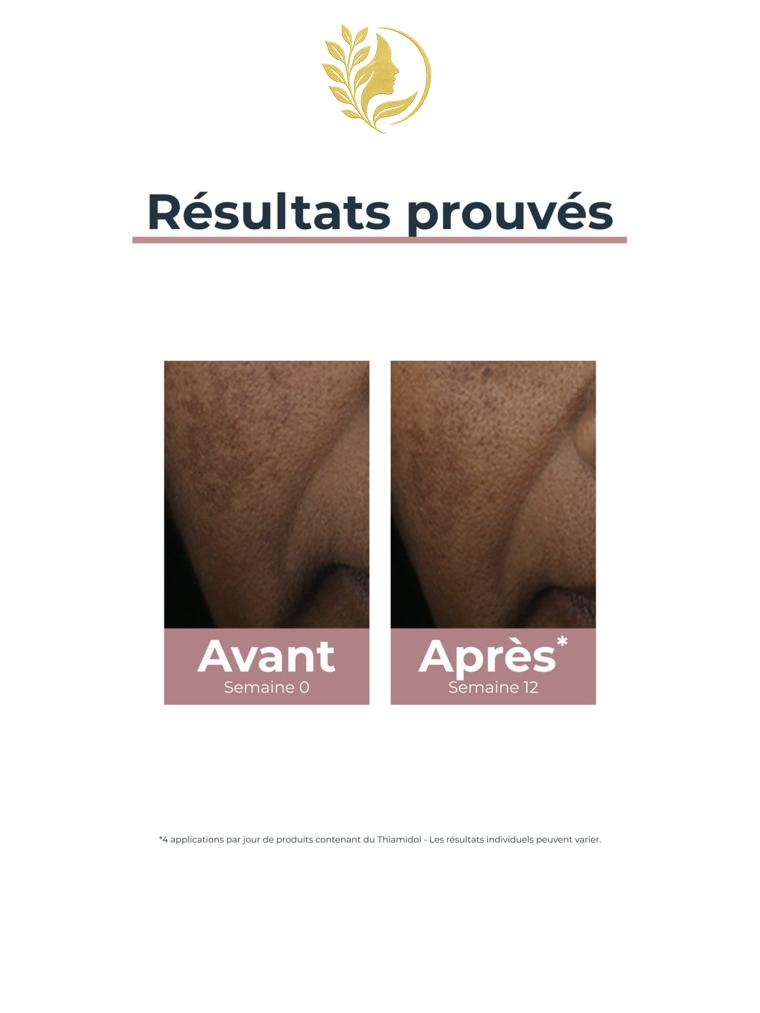 EUCERIN ANTI-PIGMENT CORRECTEUR DE TACHES - 5 ML -