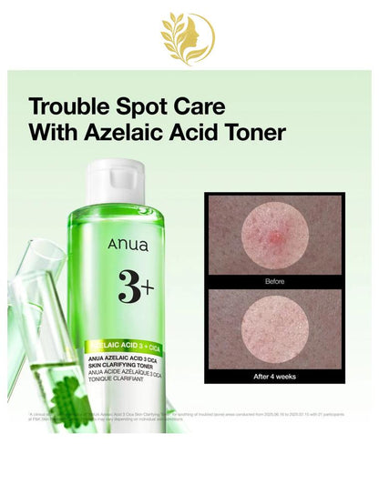 ANUA AZELAIC ACID 3+ CICA TONIQUE CLARIFIANT - 250 ML -