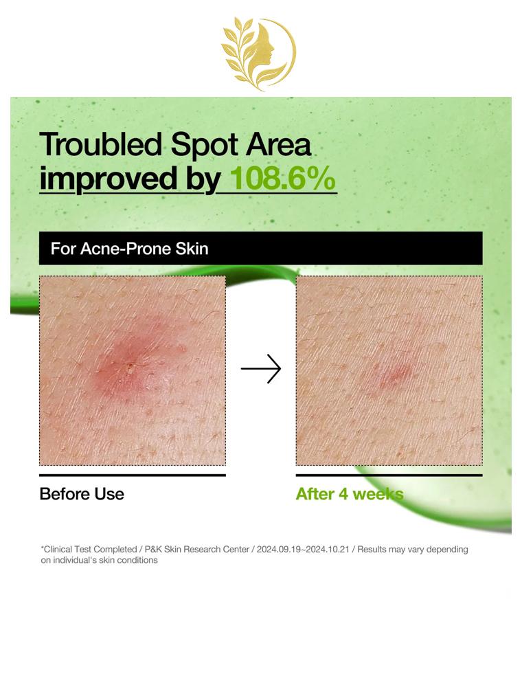 ANUA AZELAIC ACID 10 HYALURON REDNESS SOOTHING SERUM - 30 ML -