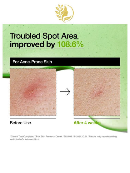 ANUA AZELAIC ACID 10 HYALURON REDNESS SOOTHING SERUM - 30 ML -
