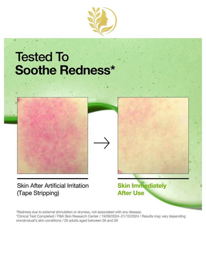 ANUA AZELAIC ACID 10 HYALURON REDNESS SOOTHING SERUM - 30 ML -