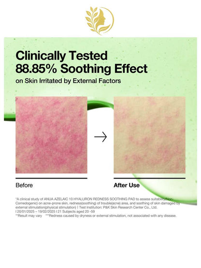 ANUA AZELAIC 10 HYALURON REDNESS SOOTHING PAD - 90 PADS -