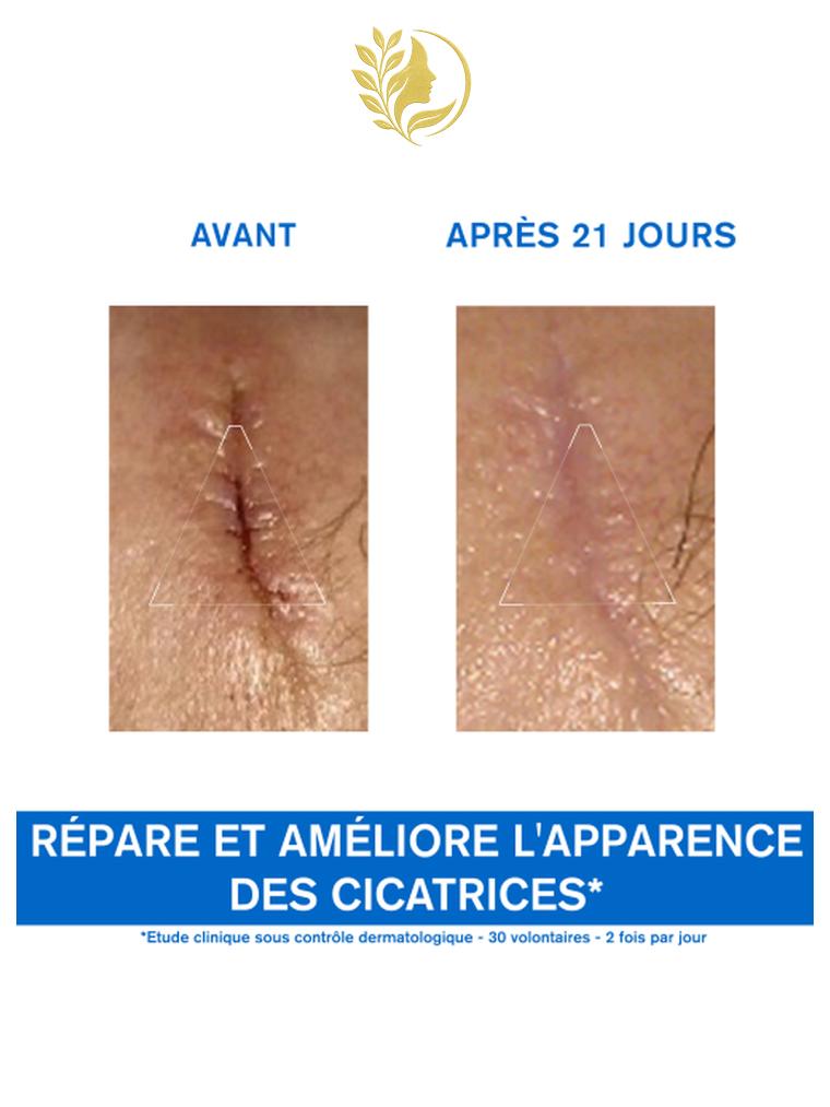 URIAGE BARIÉDERM - CRÈME RÉPARATRICE AU CU-ZN PROTÈGE ET PRÉVIENT IRRITATIONS ET FROTTEMENT DES CUISSES - 40 ML -