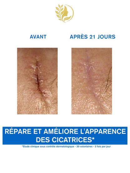 URIAGE BARIÉDERM - CRÈME RÉPARATRICE AU CU-ZN PROTÈGE ET PRÉVIENT IRRITATIONS ET FROTTEMENT DES CUISSES - 40 ML -