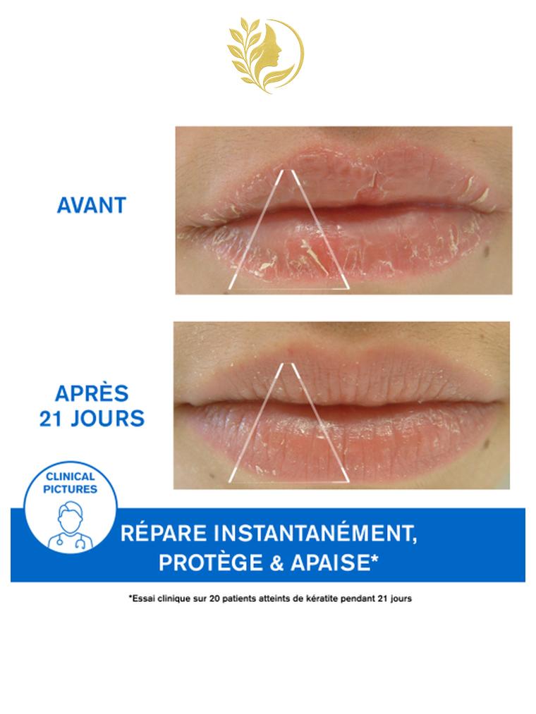 URIAGE BARIÉDERM-CICA BAUME LÈVRES PROTECTEUR  LÈVRES GERCÉES, DÉSSÉCHÉES, ABÎMÉES - 15 ML -