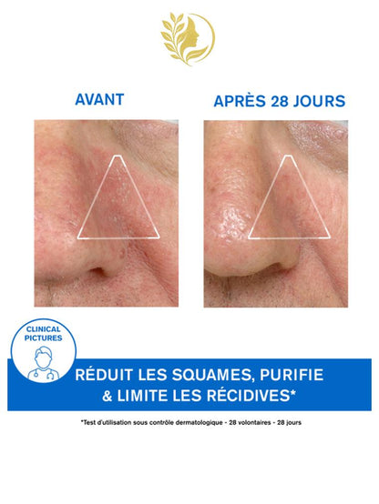 URIAGE DS - ÉMULSION APAISANTE RÉGULATRICE DIMINUTION DES SQUAMES ET ROUGEURS - 40 ML -