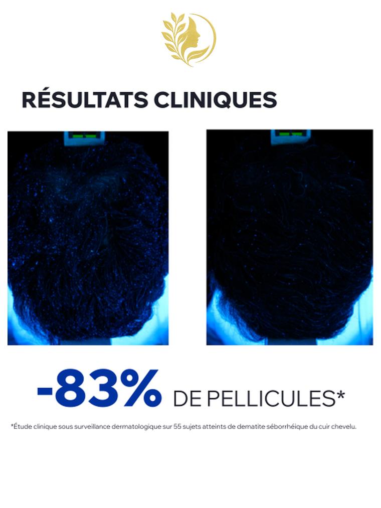 URIAGE DS HAIR - LOTION ANTIPELLICULAIRE RÉGULATRICE  CUIR CHEVELU APAISÉ ET PELLICULES ÉLIMINÉES - 100 ML -