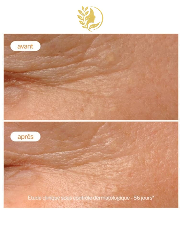 NOVEXPERT 1* LA CRÈME PEELING DE NUIT - 40 ML -