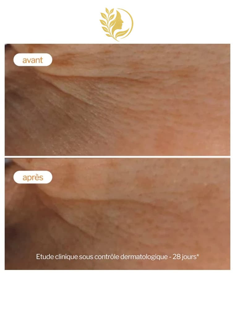 NOVEXPERT 1* SOIN PEELING ECLAT VITAMINE C - 30 ML -