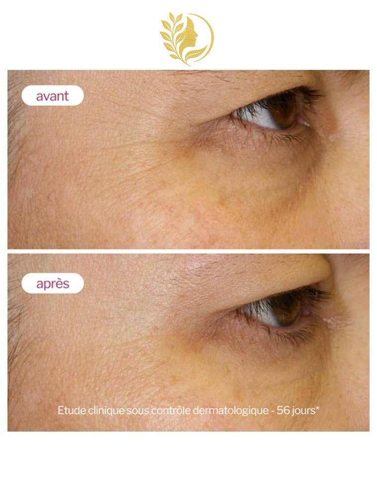 NOVEXPERT 2* LA CRÈME REPULP - 40 ML -