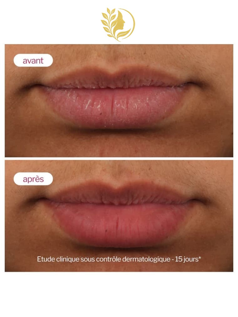 NOVEXPERT 2* LIP'UP - 8 ML -