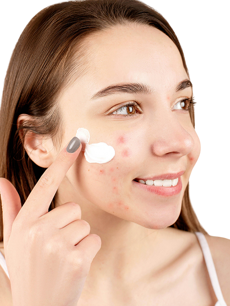 Acné & imperfections