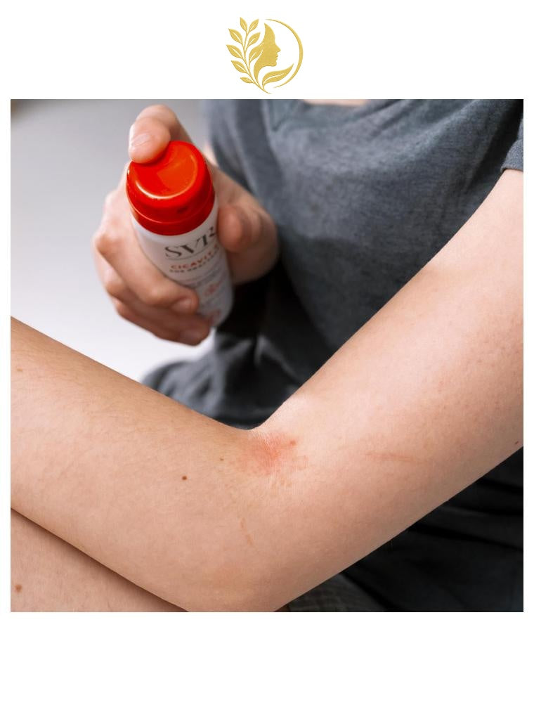 SVR CICAVIT+ SOS GRATTAGE - SPRAY ANTI-GRATTAGE APAISANT ANTI-MARQUES - 40 ML -