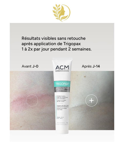 ACM TRIGOPAX SOIN PROTECTEUR ET APAISANT - 30 ML -