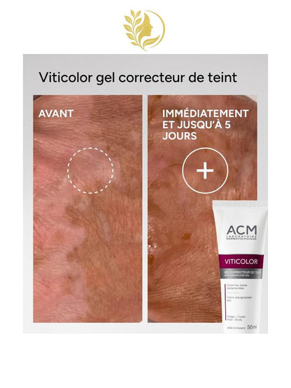 ACM VITICOLOR GEL CORRECTEUR DE TEINT - 50 ML -